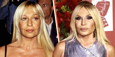 crystal versace before surgery|donatella Versace plastic surgery.